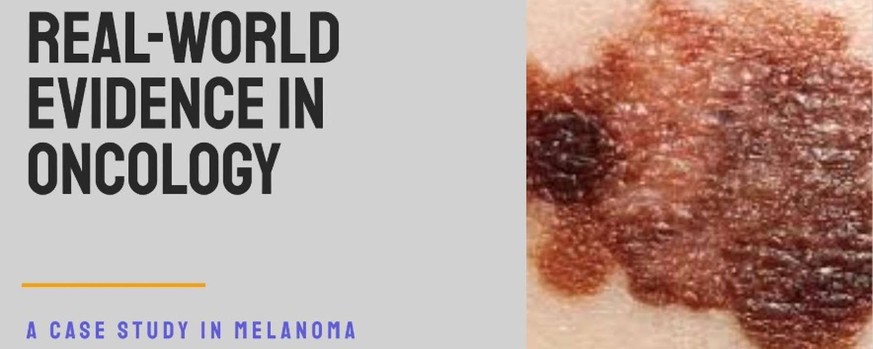 Case Study: Real-World Evidence Project in Oncology